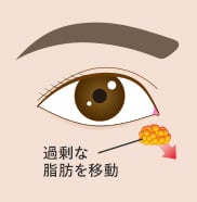 裏ハムラ 傷跡 イメージ