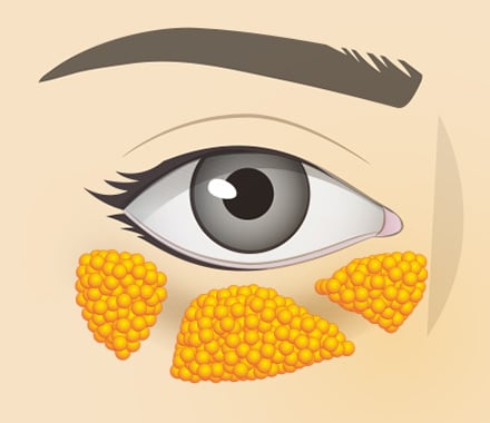 状態に合わせた治療法をご提案