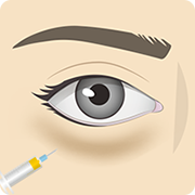 脂肪注入 イメージ