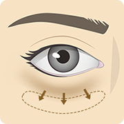 裏ハムラ法 イメージ