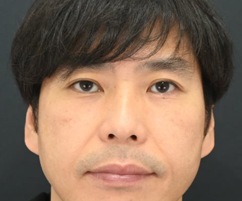 症例写真01_after