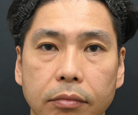 症例写真01_before